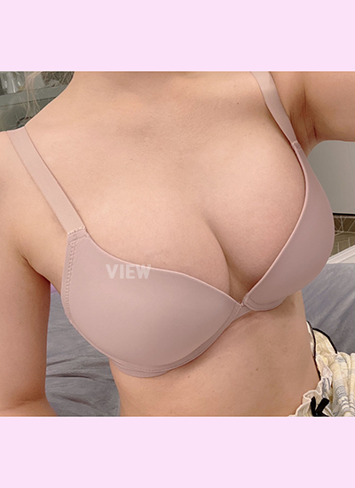 breast augmentation in Korea