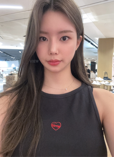 3 Months Rhinoplasty Results in Korea