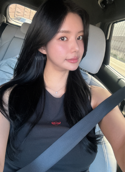 4 Months Rhinoplasty Results in Korea
