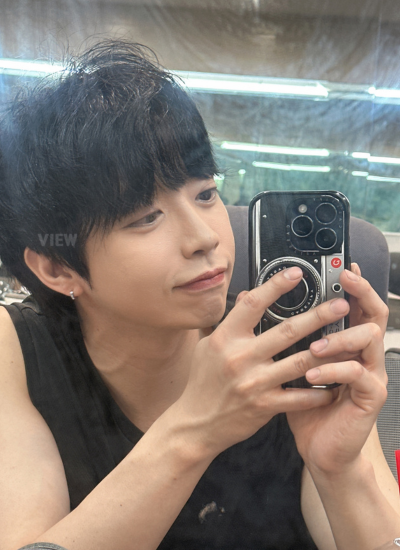 Five month after plastic surgery in Korea