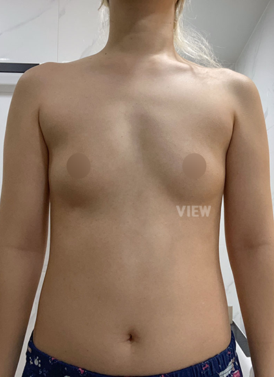 Pre-Surgery Consultation at View Plastic Surgery, Seoul