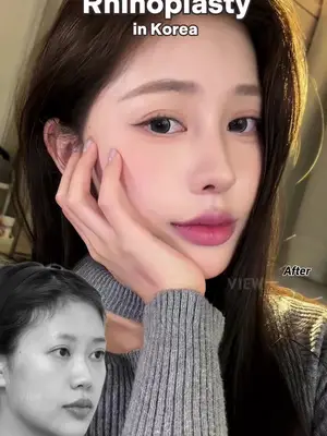 Me but better version Copyrights to images and all other materials related to this content belong to VIEW and you may be liable for unauthorized distribution and or reproduction of the same without written consent. #korea #jennie #makeup #beauty