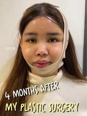 Review stem cell fat grafting in Korea Copyrights to images and all other materials related to this content belong to VIEW and you may be liable for unauthorized distribution and or reproduction of the same without written consent. #korea #vlog #stemcell #seongsu #seoul