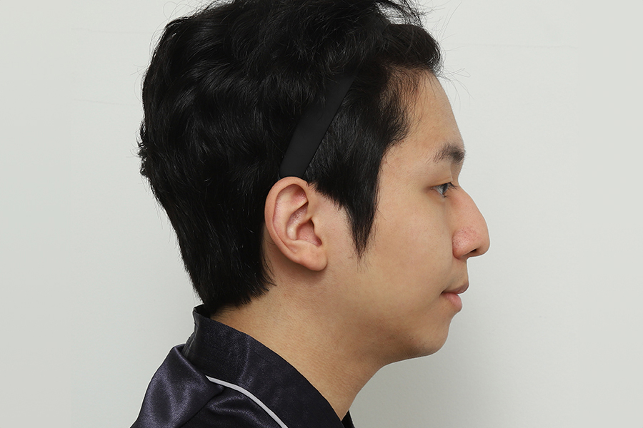 Male Surgery Before