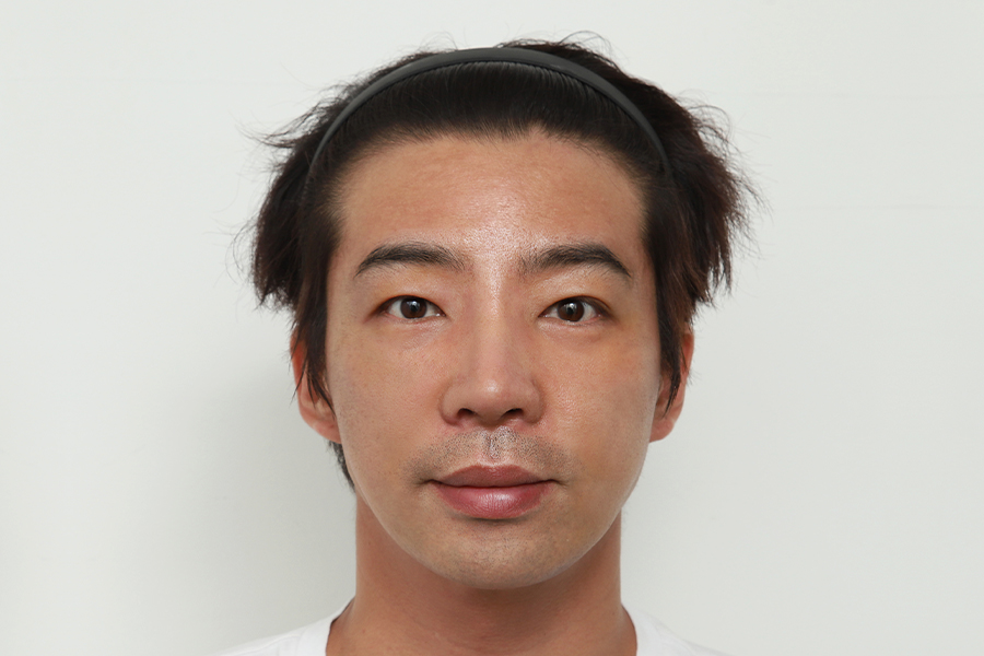 Male Surgery After