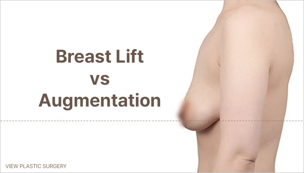 Breast Lift vs Augmentation: Post-Pregnancy Guide