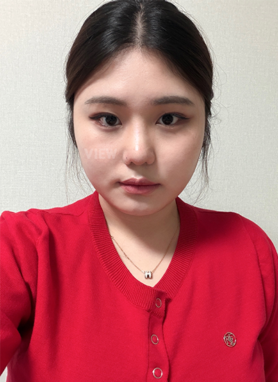 It already felt good when the external nose stitches were removed