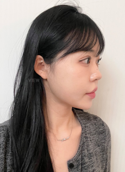 Tingling sensation after plastic surgery