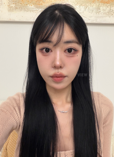 Face liposuction review