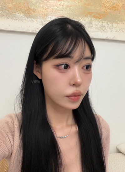 Korean plastic surgery review