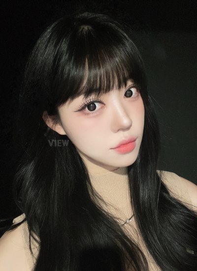 Result 6 months after thread lift and liposuction in Korea