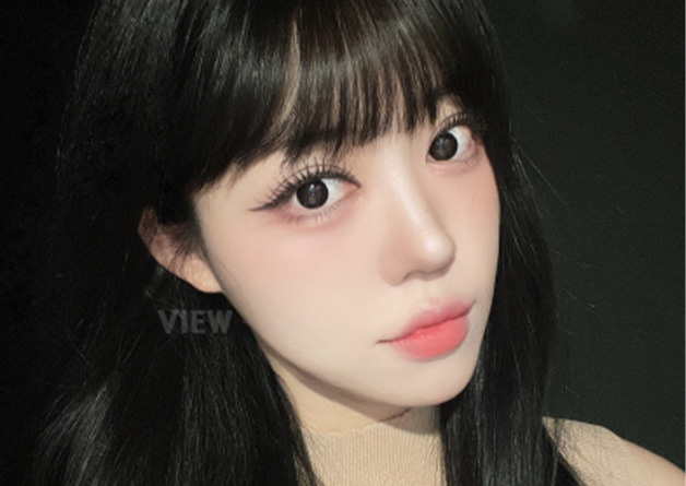 Face Liposuction in Korea Review | 1-Year Recovery Timeline
