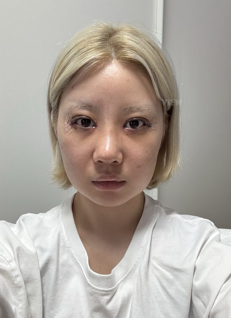 first week after surgery in korea