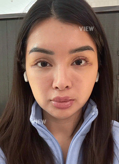 2. Why VIEW Plastic Surgery specifically?