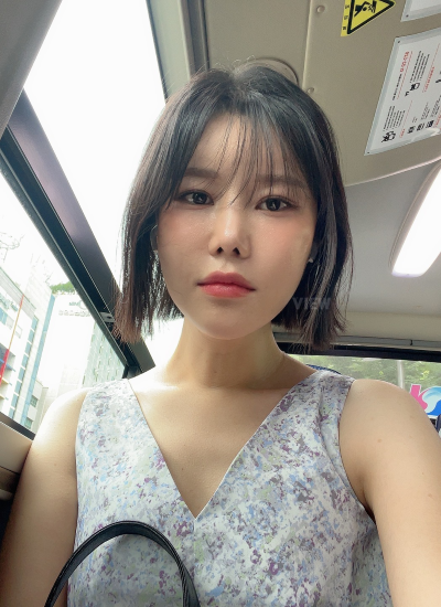 One month after fat grafting in korea