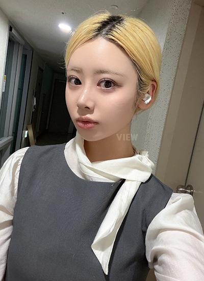 Korean Rhinoplasty for Improved Nose Shape and Facial Balance