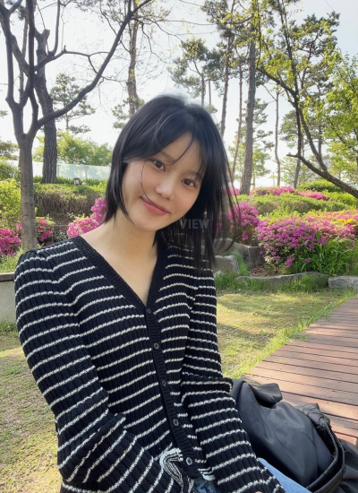 4 Months After Plastic Surgery in Korea