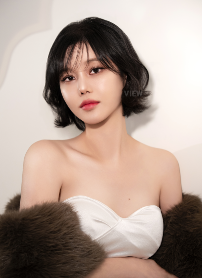 7 Months After Thread Lift in Korea