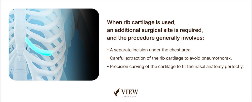Rib cartilage harvesting process for revision rhinoplasty