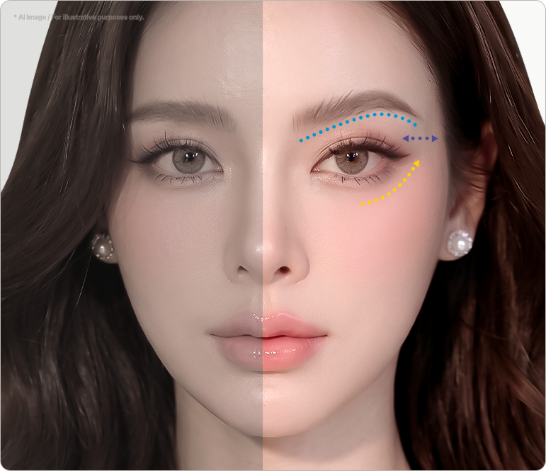 Model’s face with an arrow on one side showing how the outer eye angle is adjusted in a personalized Fox Eyes Lift