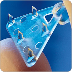 ENDOTINE multi-point tissue fixation device with several fixation points, used in Ponytail Lift