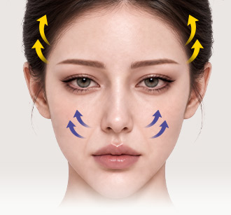 Model's face with arrows showing the lifting direction from the eye area to the cheeks in Ponytail Lift design