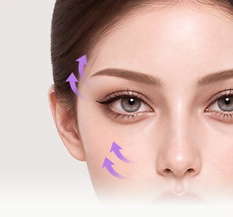 Model's eye area with arrows showing the SMAS and deeper tissues lifted together in a Deep Plane SMAS lift 