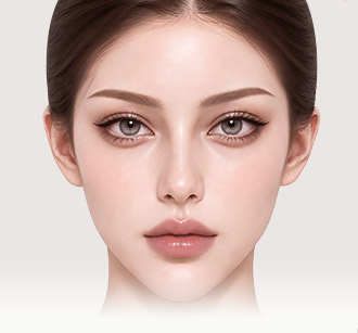 Model with a lifted, refreshed eye area and midface after the tissues are secured with fixation materials