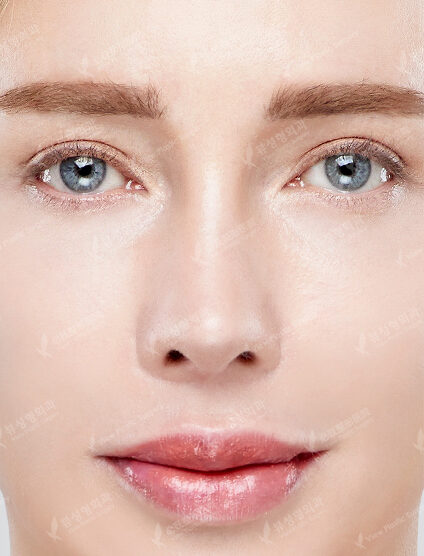 Nose After