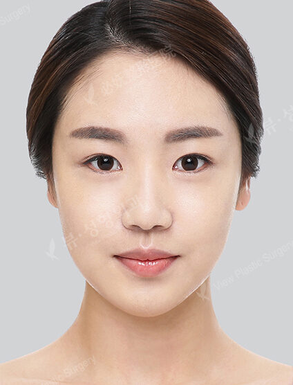 Facial Contouring After