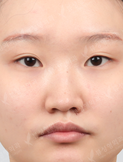 Nose Before