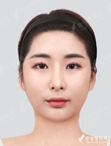 korean plastic surgery before and after jaw