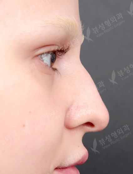 Nose Before