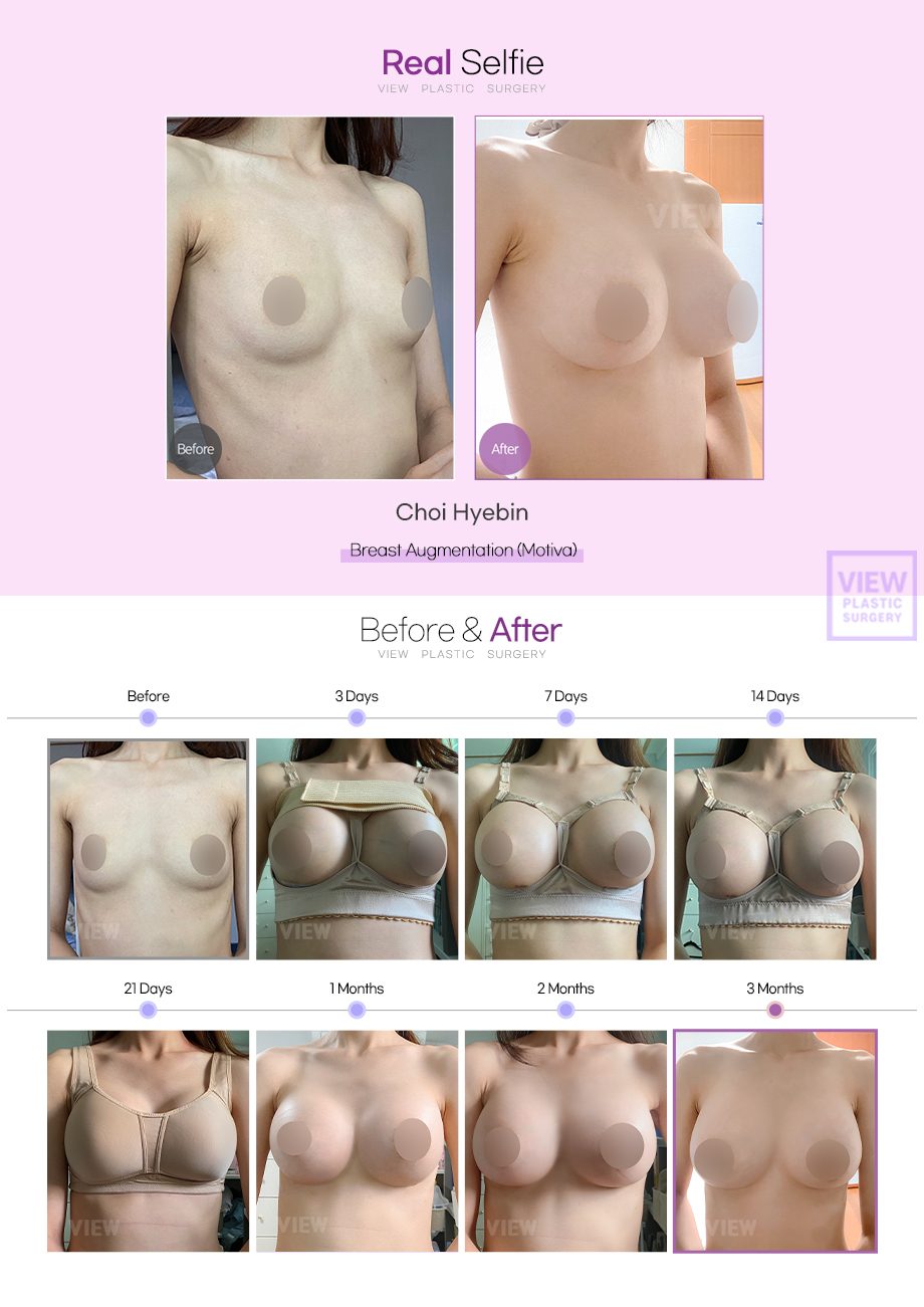 65bb31a9793bc4256893