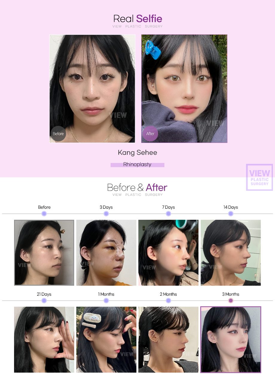 65e7cdef172533040303