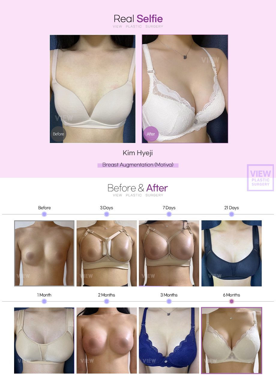 65f27219d5b8e3175694