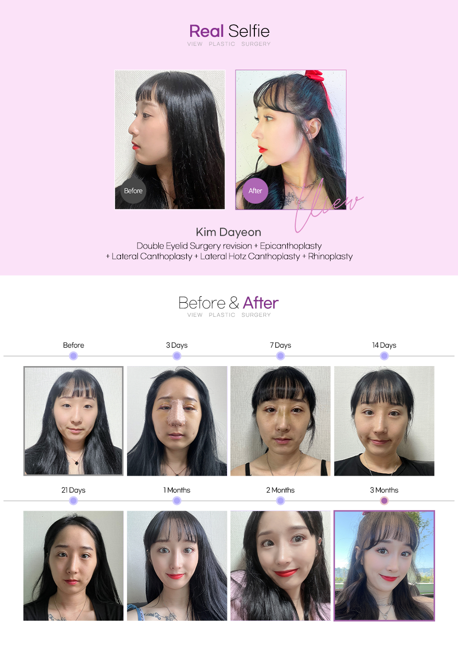 66051648038167366857