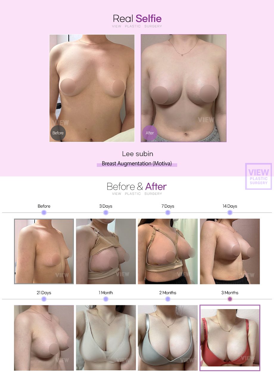 6747d23ee92b05101778