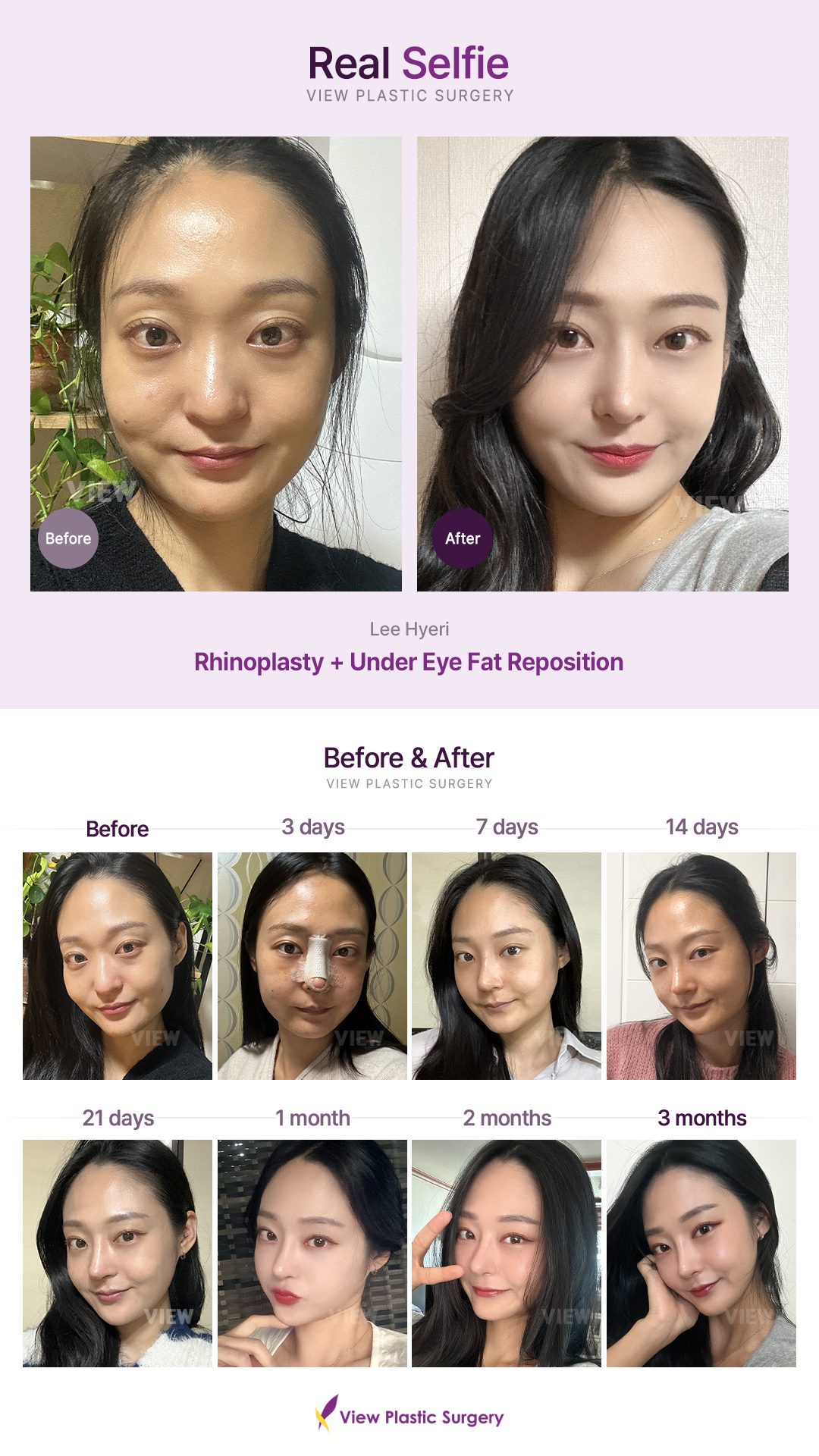 685cab9b76f558303077