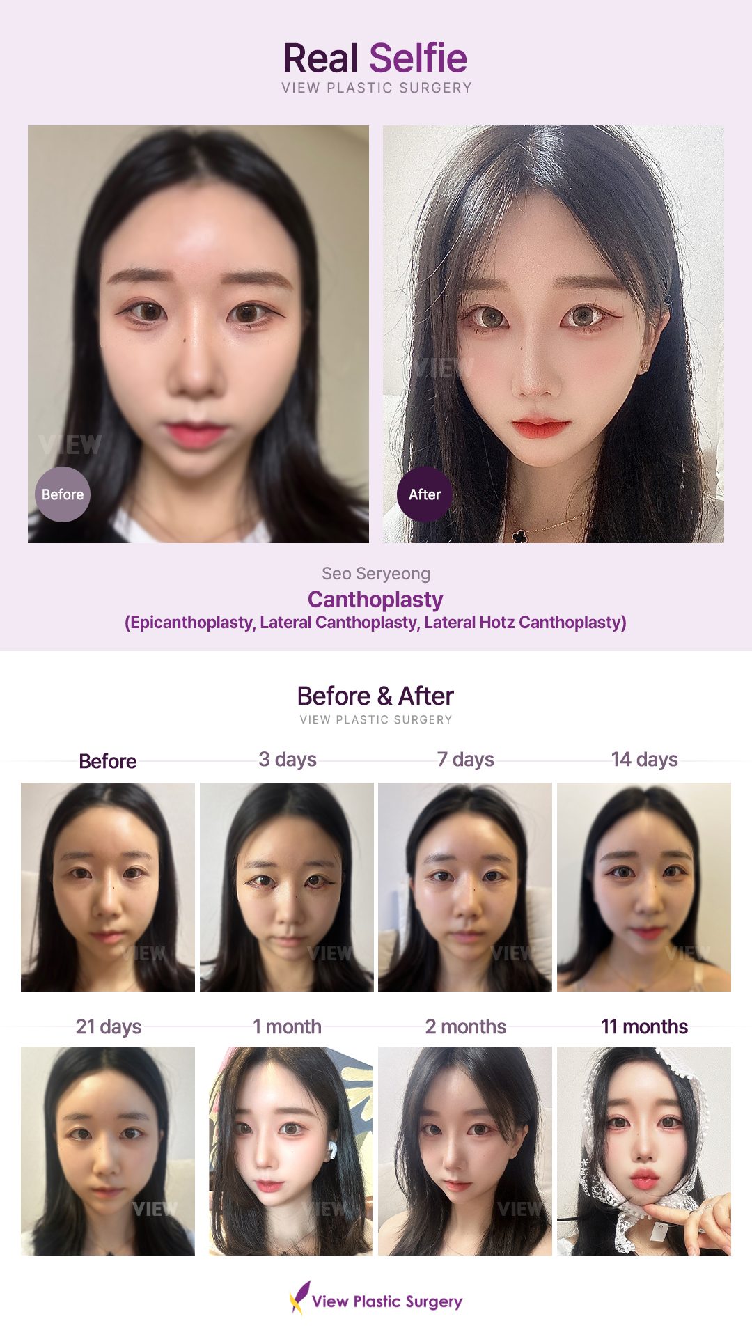 68ad1e5029e811816312