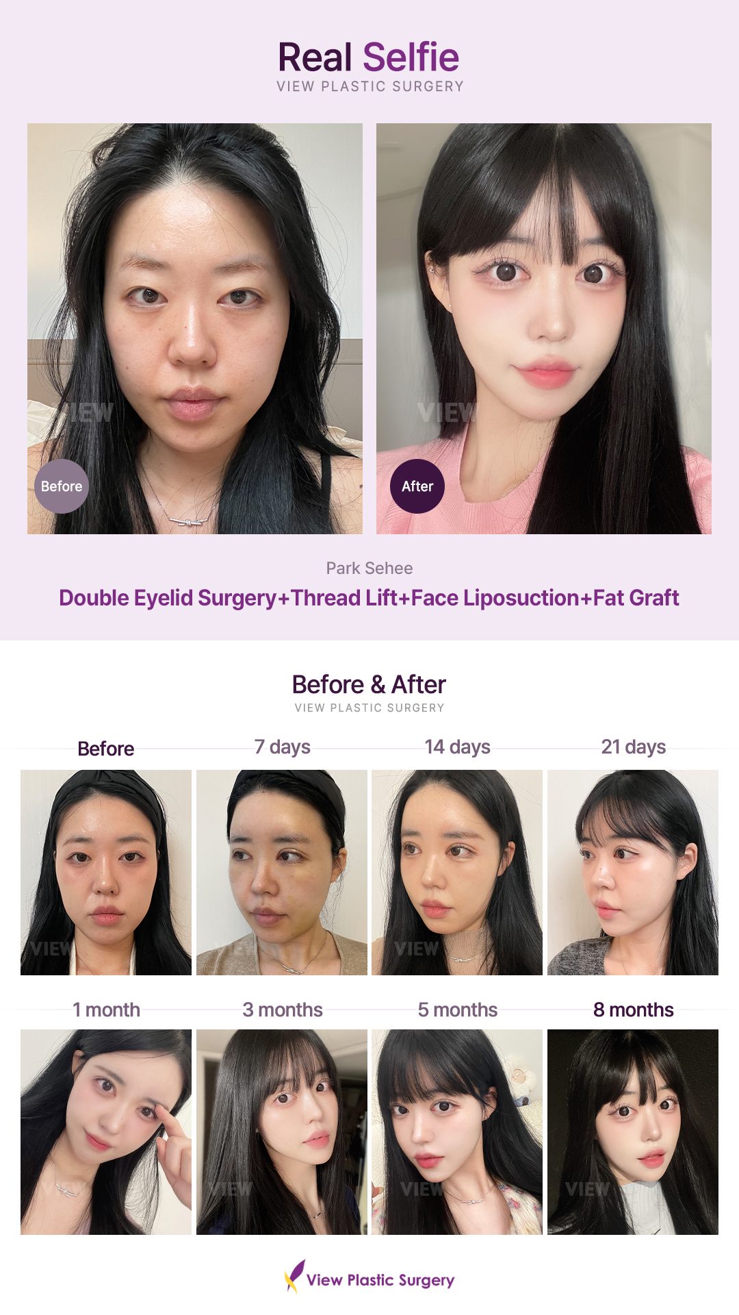 692cf9f6e96208989927