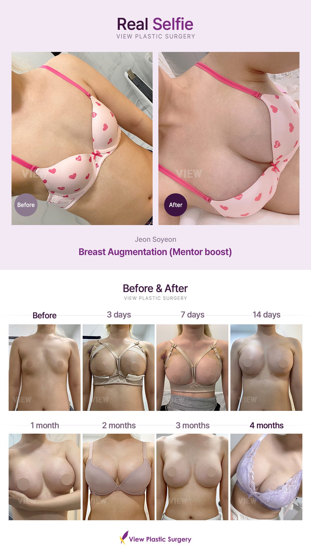 6930e9631bb0a8204225