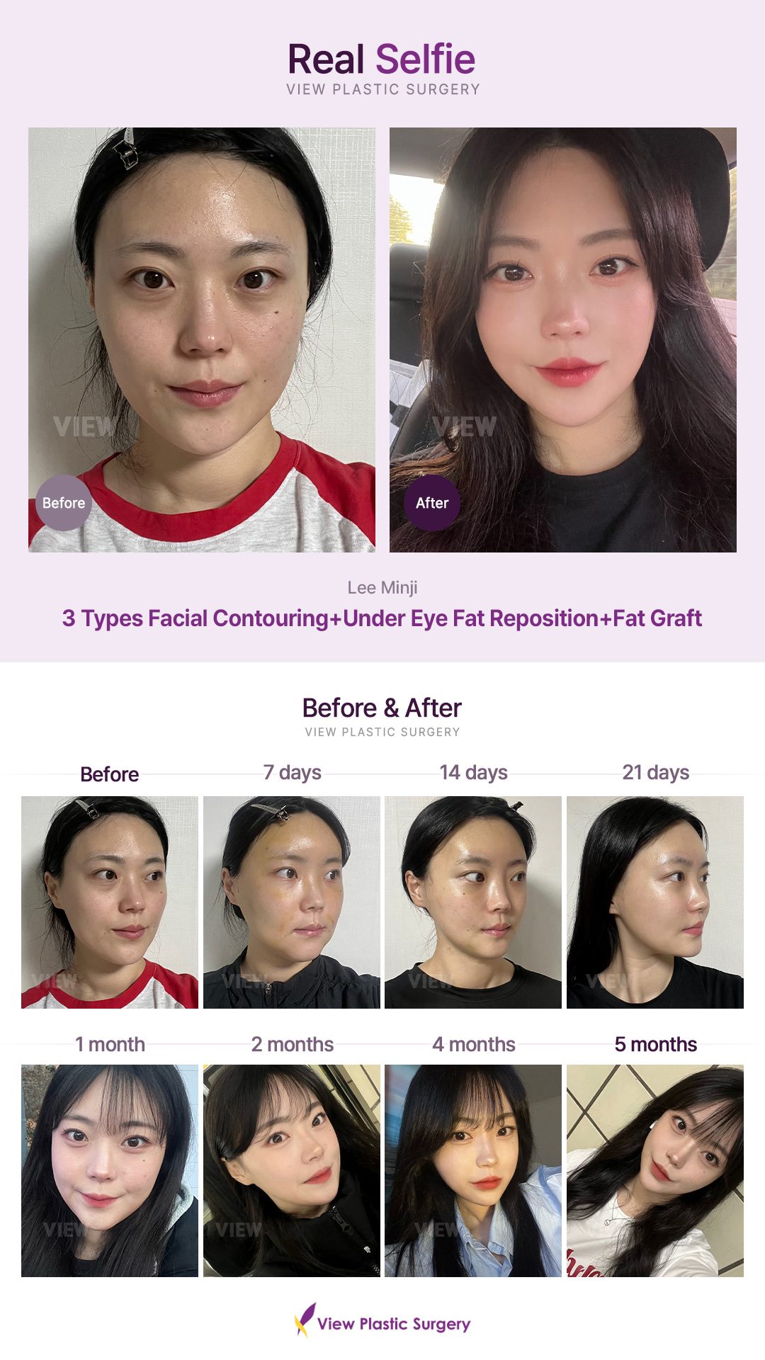 693a2d5e9a9ae3222246