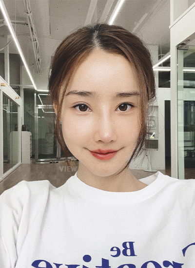 Woman one week after receiving nose job at a Korean plastic surgery clinic