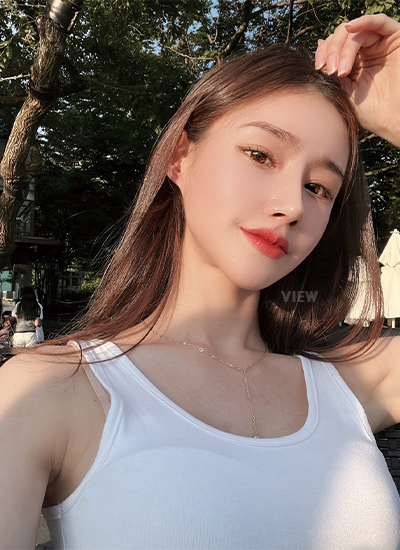 Woman one month after receiving rhinoplasty at a Korean plastic surgery clinic.