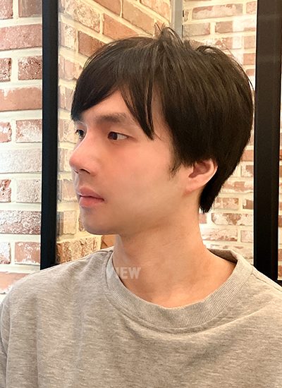 2nd week review of Male Nose Cosmetic Surgery 
