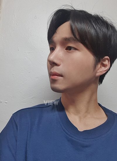 2 month review post male rhinoplasty