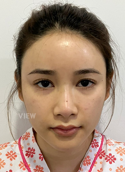 View Plastic Surgery in Korea