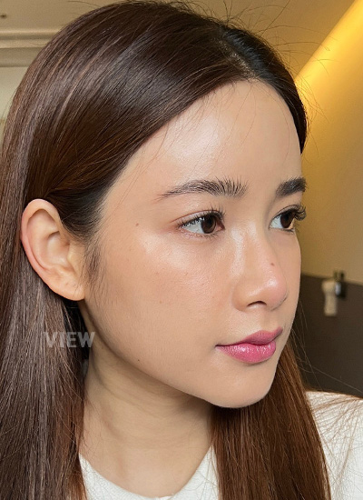 Review Plastic Surgery in Korea, Before 