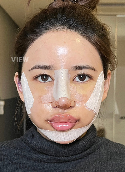 Plastic Surgery in Korea